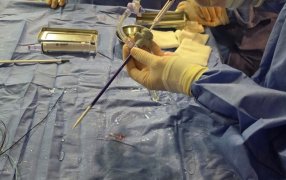 Hito en salud pública: El Hospital Dr. Ramón Madariaga en la ciudad de Posadas realizó la primera tromboaspiración pulmonar del Nordeste Argentino