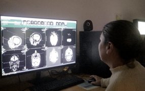 Posadas: El Madariaga Dr. Ramón Madariaga se posicionó como centro de referencia de atención de patologías neurológicas de alta complejidad