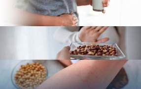 El Hospital Dr. Ramón Madariaga de la ciudad de Posadas brinda recomendaciones higiénico-dietéticas para el tratamiento de alergias alimentarias