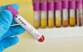 ¿Están bajando los casos de Dengue en Argentina? Qué dicen los expertos