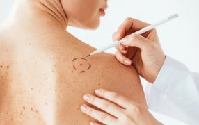 Cinco consejos para cuidarse la piel en verano