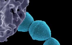 Streptococcus Pyogenes: Cuáles son los síntomas de la infección y cómo es el tratamiento