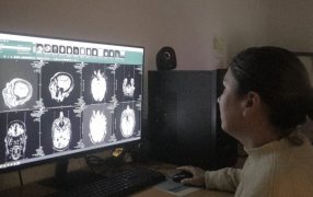El Hospital Dr. Ramón Madariaga en la ciudad de Posadas innovó con la cirugía de Epilepsia y terapias alternativas