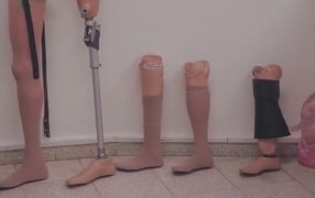 El Banco de Prótesis del Hospital Dr. Ramón Madariaga de la ciudad de Posadas se consolida en el sistema sanitario