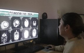 El Hospital Dr. Ramón Madariaga en la ciudad de Posadas advierte sobre los principales factores de riesgos del ACV y la importancia de la detección temprana
