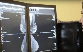 El Hospital Madariaga de la ciudad de Posadas recibió la etiqueta de Calidad en Diagnóstico Mamario del Instituto Nacional del Cáncer