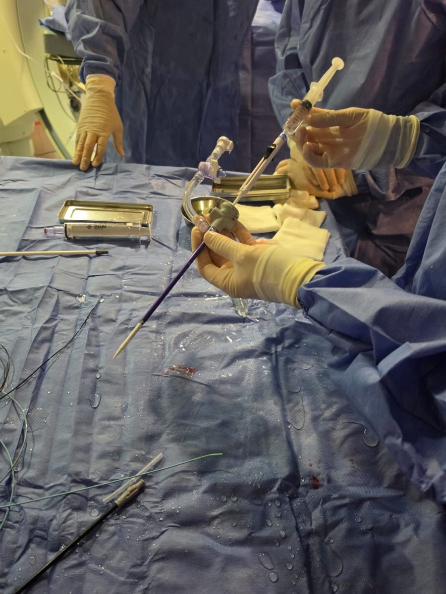 Hito en salud pública: El Hospital Dr. Ramón Madariaga en la ciudad de Posadas realizó la primera tromboaspiración pulmonar del Nordeste Argentino