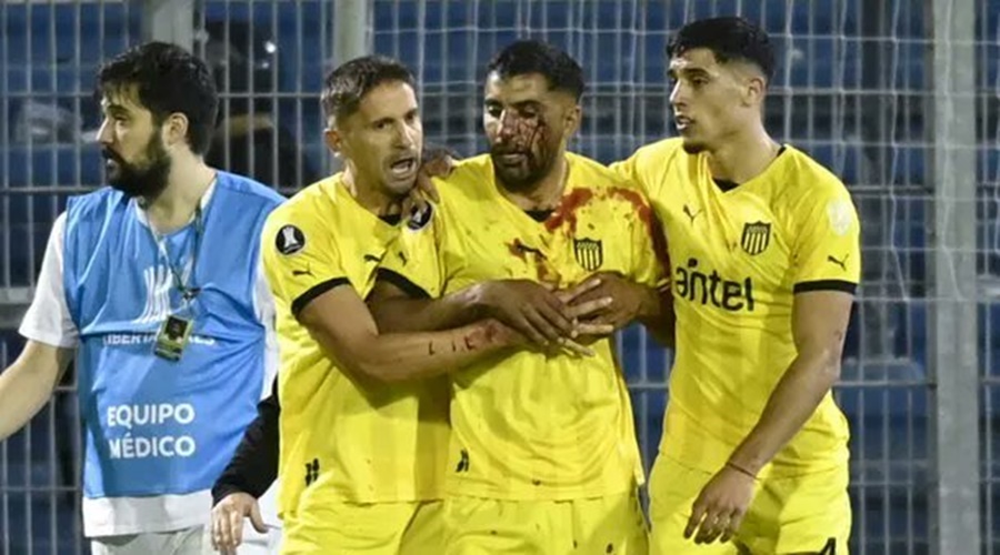 Copa Libertadores: Jugador de Peñarol de Uruguay terminó en el Hospital tras un piedrazo de un hincha de Rosario Central