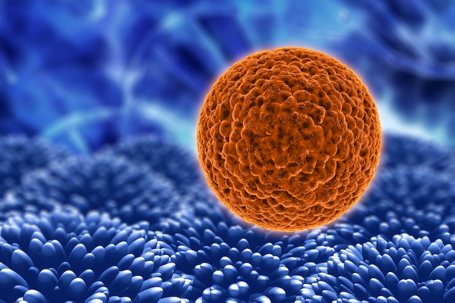 Día Mundial del Cáncer: en Argentina se detecta un caso nuevo cada 4 minutos