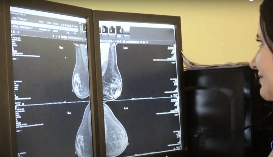 El Parque de la Salud de Misiones potencia la prevención y detección temprana del cáncer de mama