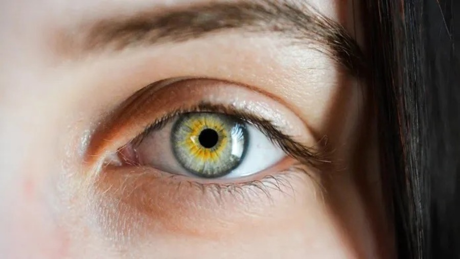Es ambulatoria: En qué consiste la blefaroplastia, la cirugía estética de ojos más elegida