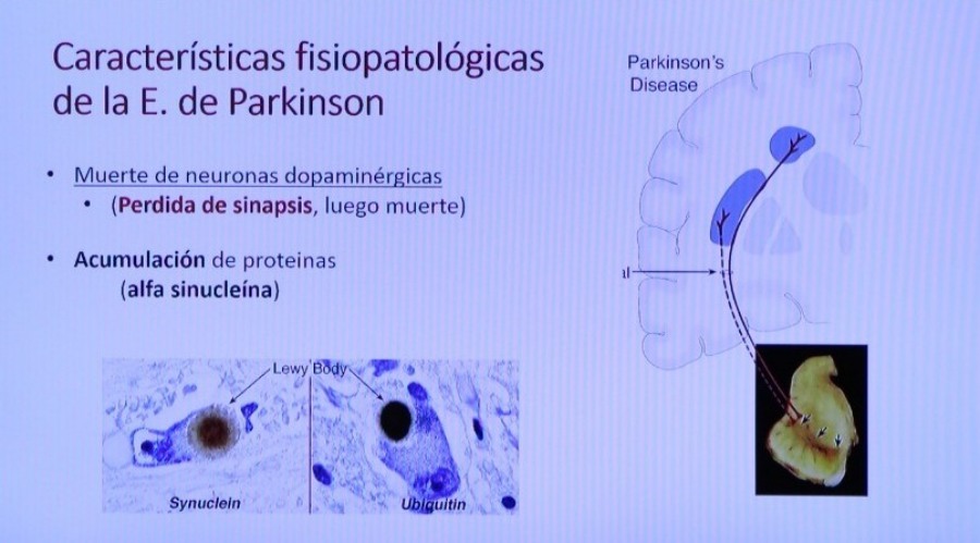 El Mate previene el Parkinson, una enfermedad en aumento en el mundo