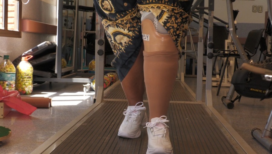 Más de 150 misioneros fueron beneficiados a través del Banco de Prótesis del Parque de la Salud Misiones