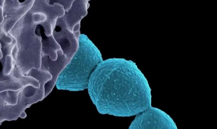 Streptococcus Pyogenes: Cuáles son los síntomas de la infección y cómo es el tratamiento