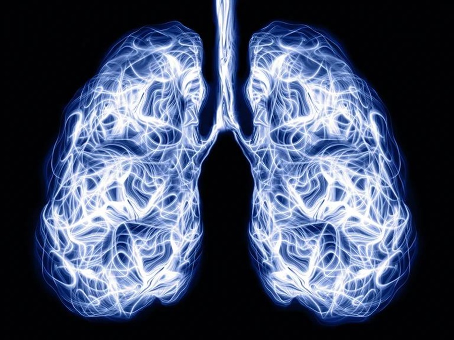 Cáncer de pulmón: Aprobaron en Argentina un tratamiento innovador que combina dos terapias