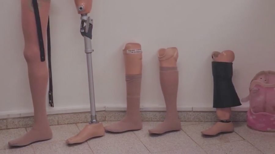 Parque de la Salud de Misiones: El Banco de Prótesis cerró 2025 con 120 entregas y refuerza la cobertura con pacientes de toda la provincia