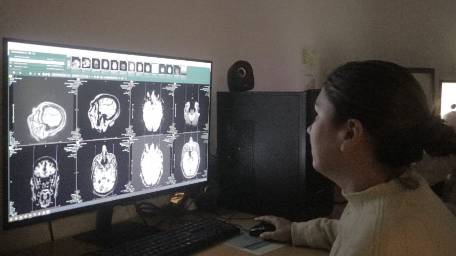 Posadas: El Hospital Dr. Ramón Madariaga realiza la innovadora cirugía de epilepsia receptiva, de desconexión y terapia de inmunomodulación